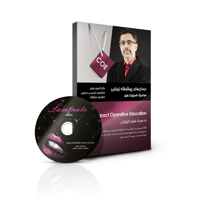 پرسلن لامینیت ونیر