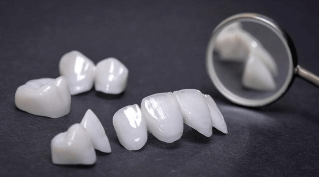  انتخاب بلوک سرامیکی در دندان پزشکی