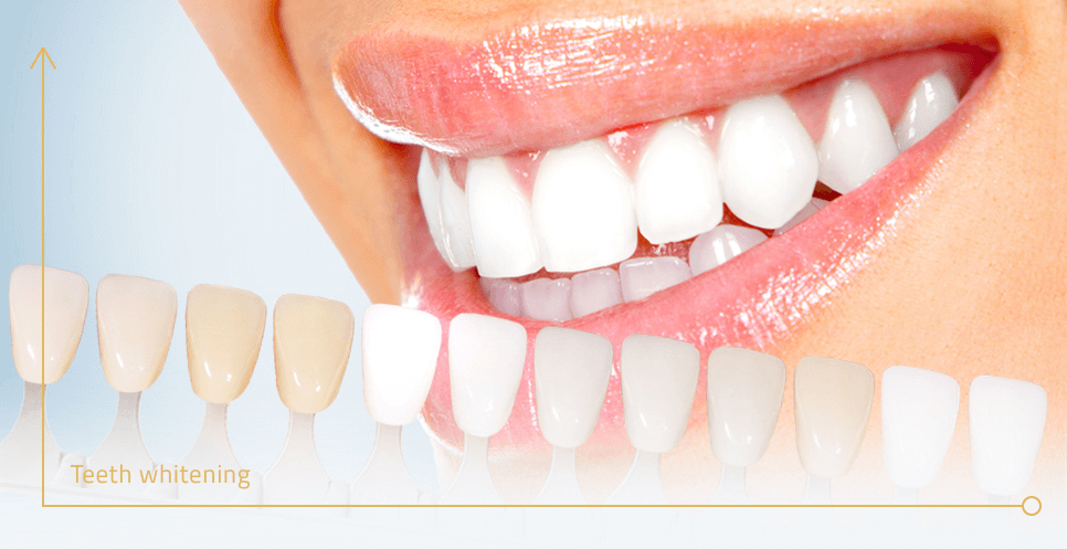 چطور دندان هایمان را سفید کنیم