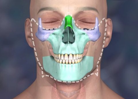 درآمد جراحان فک و صورت در ایران چقدر است؟